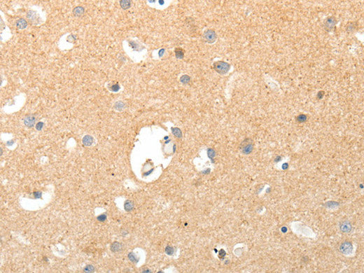 TNXB Polyclonal Antibody Store at -20°C