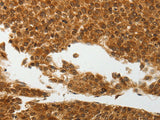 SOCS7 Polyclonal Antibody Store at -20°C