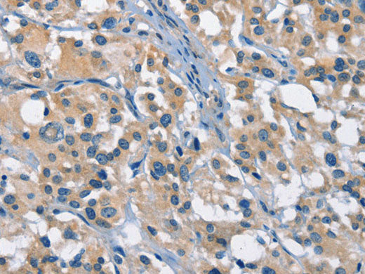 GAS2 Polyclonal Antibody Store at -20°C