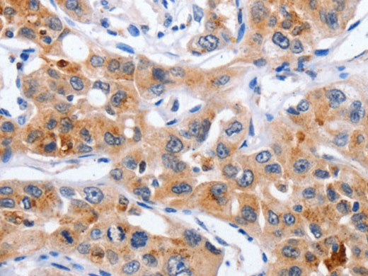 NCK1 Polyclonal Antibody Store at -20°C