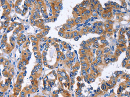 IGSF10 Polyclonal Antibody Store at -20°C