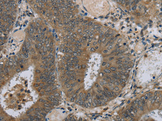 HSD3B1 Polyclonal Antibody Store at -20°C