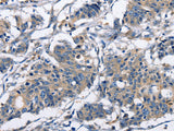 CAPZA2 Polyclonal Antibody
