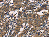 SENP1 Polyclonal Antibody Store at -20°C