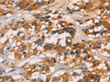 CD80 Polyclonal Antibody Store at -20°C