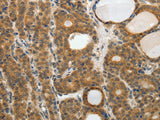 RARA Polyclonal Antibody