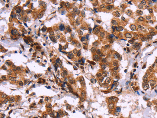 CARD11 Polyclonal Antibody Store at -20°C
