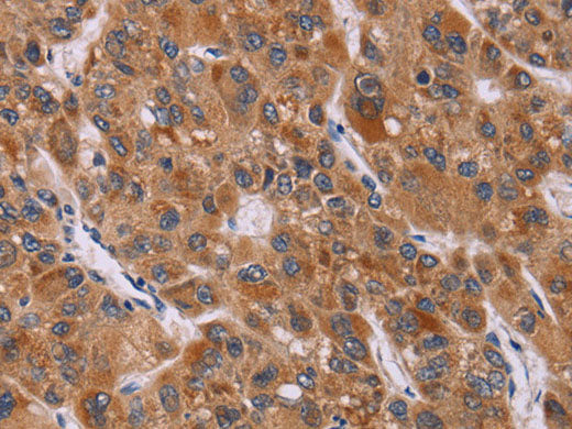 CALCA Polyclonal Antibody Store at -20°C