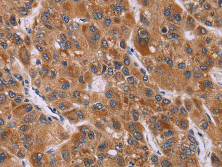 CALCA Polyclonal Antibody Store at -20°C