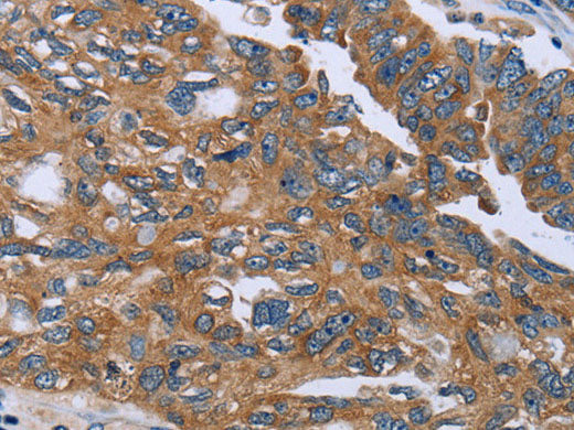 GAB2 Polyclonal Antibody Store at -20°C