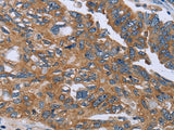 GAB2 Polyclonal Antibody Store at -20°C