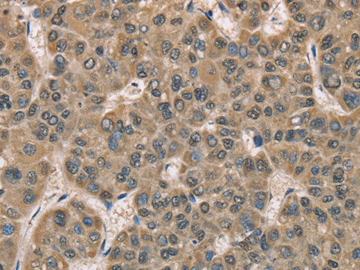 DACH2 Polyclonal Antibody Store at -20°C
