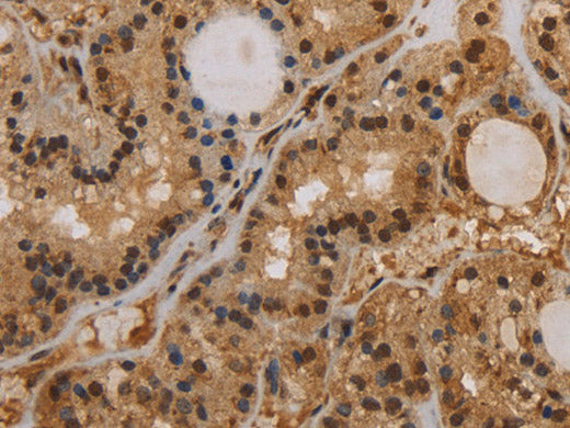 KCNN4 Polyclonal Antibody Store at -20°C