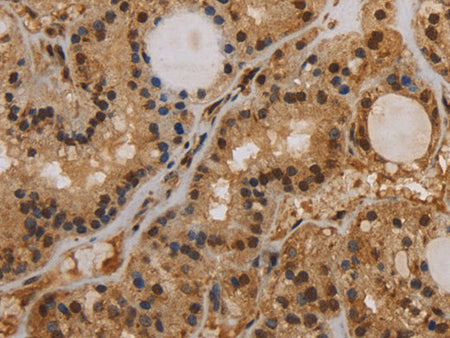 KCNN4 Polyclonal Antibody Store at -20°C