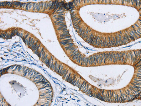 SULT1B1 Polyclonal Antibody Store at -20°C