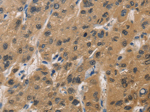 DUSP26 Polyclonal Antibody Store at -20°C