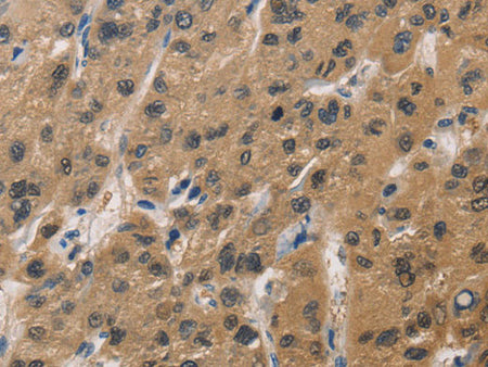 DUSP26 Polyclonal Antibody Store at -20°C