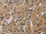 DUSP26 Polyclonal Antibody Store at -20°C