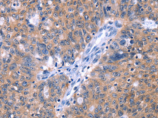 ZNF395 Polyclonal Antibody