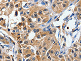 DUSP8 Polyclonal Antibody