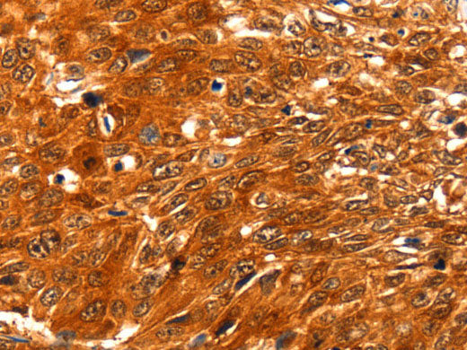 SERPINB5 Polyclonal Antibody Store at -20°C