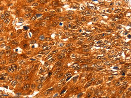 SERPINB5 Polyclonal Antibody Store at -20°C