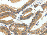 MDK Polyclonal Antibody
