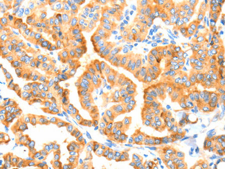 MANF Polyclonal Antibody Store at -20°C