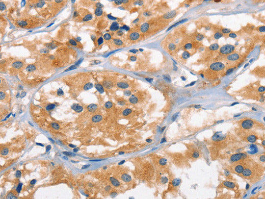AHR Polyclonal Antibody Store at -20°C