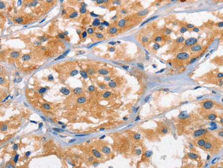 AHR Polyclonal Antibody Store at -20°C