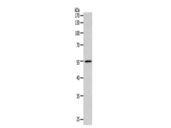 PAX1 Polyclonal Antibody Store at -20°C