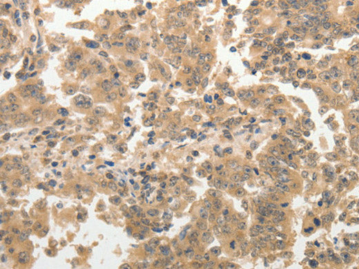 ADAR Polyclonal Antibody Store at -20°C