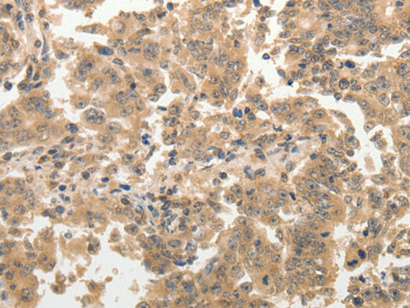 ADAR Polyclonal Antibody Store at -20°C