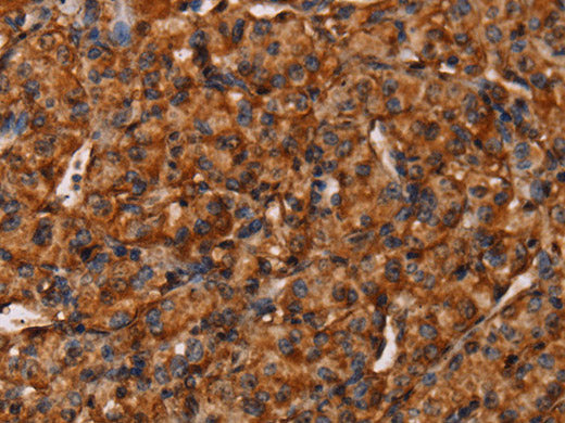 COL18A1 Polyclonal Antibody Store at -20°C