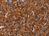 COL18A1 Polyclonal Antibody Store at -20°C