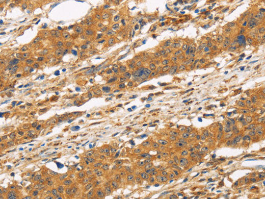 CD22 Polyclonal Antibody Store at -20°C