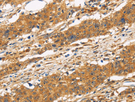 CD22 Polyclonal Antibody Store at -20°C