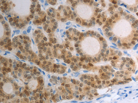 S100A1 Polyclonal Antibody Store at -20°C
