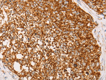AK2 Polyclonal Antibody Store at -20°C