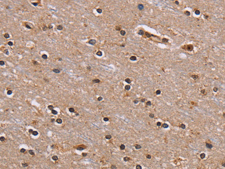 GNL3 Polyclonal Antibody Store at -20°C