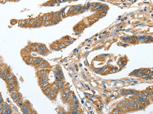 CKAP2 Polyclonal Antibody Store at -20°C