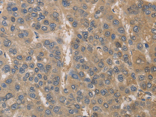 DPYSL3 Polyclonal Antibody Store at -20°C