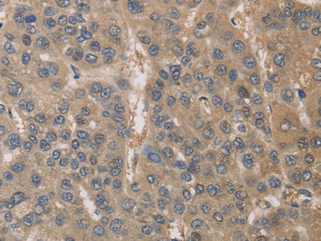 DPYSL3 Polyclonal Antibody Store at -20°C