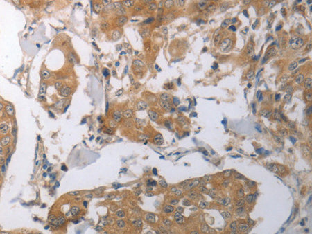 SHH Polyclonal Antibody Store at -20°C