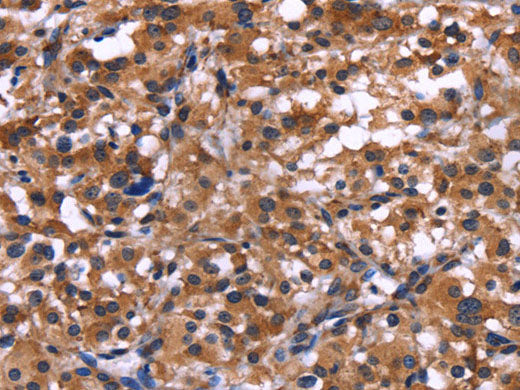 IL1A Polyclonal Antibody Store at -20°C