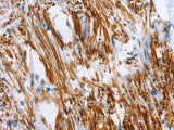 SHROOM2 Polyclonal Antibody