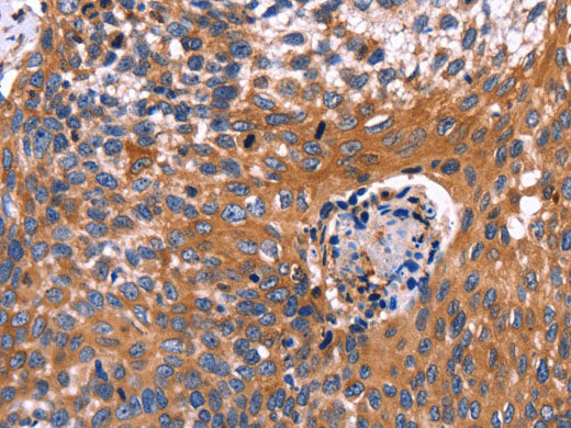 RDX Polyclonal Antibody Store at -20°C