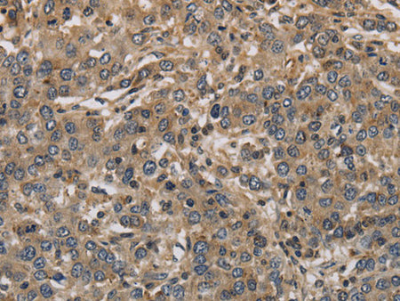 KCNA7 Polyclonal Antibody Store at -20°C