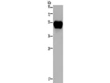 CD160 Polyclonal Antibody Store at -20°C