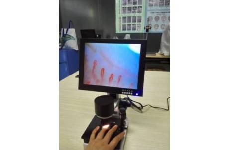 MSE PRO 10inch Microcirculation Microscope